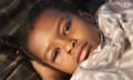 Awadin Mohammed, 10, lies on a hospital bed