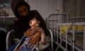 A woman dressed in black holds a screaming baby who has feeding tubes attached to her